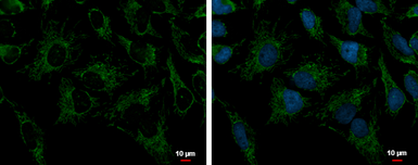 Anti-PRX III antibody [N1C3] used in Immunocytochemistry/ Immunofluorescence (ICC/IF). GTX112004