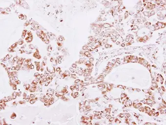 Anti-PRX III antibody [N1C3] used in IHC (Paraffin sections) (IHC-P). GTX112004