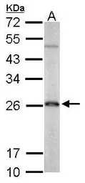 Anti-PRX III antibody [N1C3] used in Western Blot (WB). GTX112004