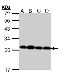 Anti-PRX III antibody [N1C3] used in Western Blot (WB). GTX112004