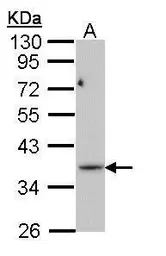 Anti-PRPS1L1 antibody used in Western Blot (WB). GTX112011