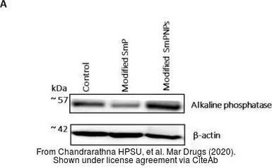 Anti-Alkaline phosphatase (intestinal) antibody used in Western Blot (WB). GTX112100