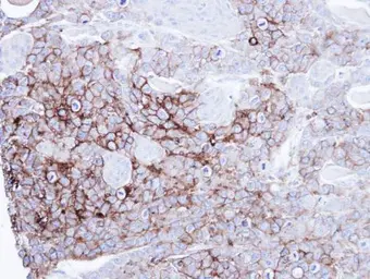 Anti-Alkaline phosphatase (intestinal) antibody used in IHC (Paraffin sections) (IHC-P). GTX112100