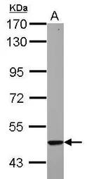 Anti-Cytokeratin 23 antibody used in Western Blot (WB). GTX112183