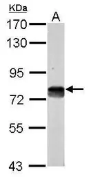 Anti-DMTF1 antibody [N3C2], Internal used in Western Blot (WB). GTX112228