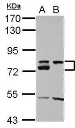 Anti-DMTF1 antibody [N3C2], Internal used in Western Blot (WB). GTX112228