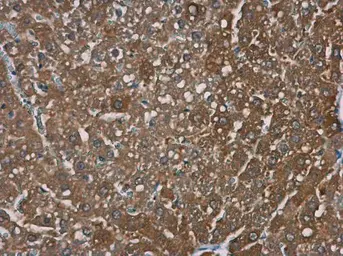 Anti-TRPM2 antibody [N1N2-2], N-term used in IHC (Paraffin sections) (IHC-P). GTX112252