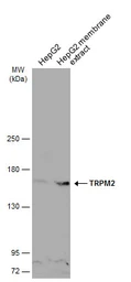 Anti-TRPM2 antibody [N1N2-2], N-term used in Western Blot (WB). GTX112252