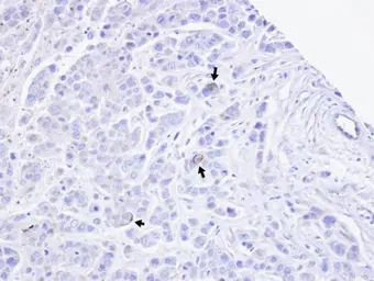 Anti-TRPM2 antibody [N1N2-2], N-term used in IHC (Paraffin sections) (IHC-P). GTX112252