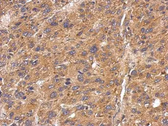 Anti-Fetuin B antibody used in IHC (Paraffin sections) (IHC-P). GTX112260