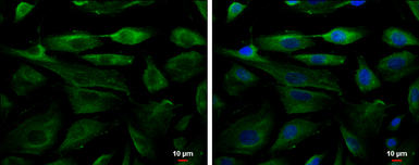 Anti-Fetuin B antibody used in Immunocytochemistry/ Immunofluorescence (ICC/IF). GTX112260