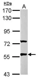 Anti-GABRR2 antibody used in Western Blot (WB). GTX112276