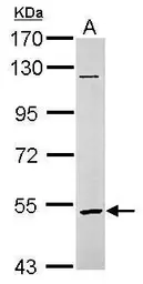 Anti-GABRR2 antibody used in Western Blot (WB). GTX112276