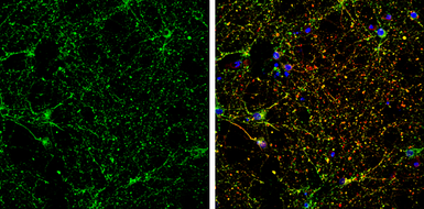 Anti-CRMP5 antibody [N1C1] used in Immunocytochemistry/ Immunofluorescence (ICC/IF). GTX112287