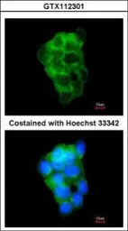 Anti-PPFIBP2 antibody used in Immunocytochemistry/ Immunofluorescence (ICC/IF). GTX112301