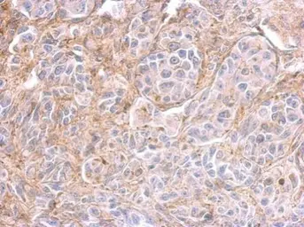 Anti-PPFIBP2 antibody used in IHC (Paraffin sections) (IHC-P). GTX112301