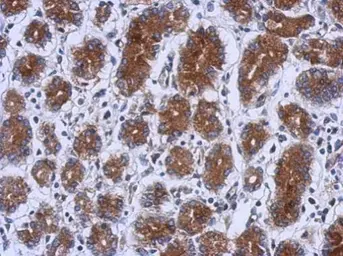 Anti-RENT1 antibody [N1N2], N-term used in IHC (Paraffin sections) (IHC-P). GTX112303