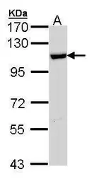 Anti-HSPA4 antibody [N1N3] used in Western Blot (WB). GTX112329