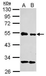 Anti-eIF3e antibody used in Western Blot (WB). GTX112342