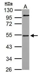 Anti-NAB1 antibody used in Western Blot (WB). GTX112354