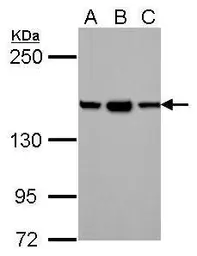 Anti-HDLBP antibody [N2C1], Internal used in Western Blot (WB). GTX112369