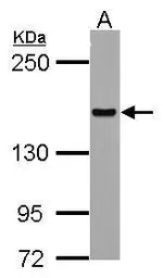 Anti-HDLBP antibody [N2C1], Internal used in Western Blot (WB). GTX112369