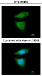 Anti-DYNC1I2 antibody used in Immunocytochemistry/ Immunofluorescence (ICC/IF). GTX112419