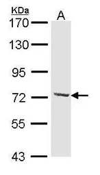 Anti-DYNC1I2 antibody used in Western Blot (WB). GTX112419