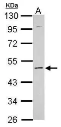 Anti-KCNS2 antibody used in Western Blot (WB). GTX112451