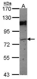 Anti-GPIP137 antibody [C1C3] used in Western Blot (WB). GTX112462