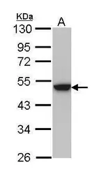 Anti-Cytokeratin 31 antibody [N1C1] used in Western Blot (WB). GTX112530