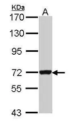 Anti-GBP3 antibody [N1C1] used in Western Blot (WB). GTX112554