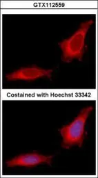 Anti-GANC antibody [N3C2], Internal used in Immunocytochemistry/ Immunofluorescence (ICC/IF). GTX112559