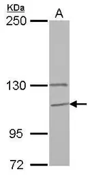 Anti-GANC antibody [N3C2], Internal used in Western Blot (WB). GTX112559