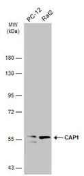 Anti-CAP1 antibody [C1C3] used in Western Blot (WB). GTX112578