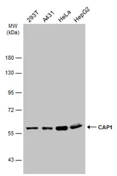 Anti-CAP1 antibody [C1C3] used in Western Blot (WB). GTX112578