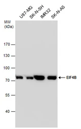 Anti-eIF4B antibody [N1N2], N-term used in Western Blot (WB). GTX112612