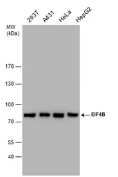 Anti-eIF4B antibody [N1N2], N-term used in Western Blot (WB). GTX112612