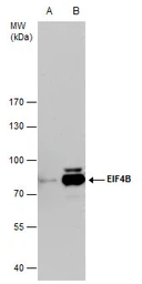 Anti-eIF4B antibody [N1N2], N-term used in Western Blot (WB). GTX112612