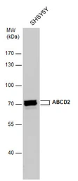 Anti-ABCD2 antibody [N3C2], Internal used in Western Blot (WB). GTX112623