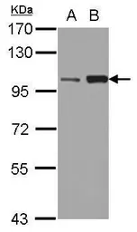 Anti-KIF3C antibody used in Western Blot (WB). GTX112629