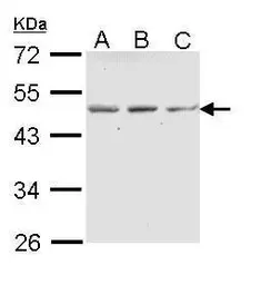 Anti-ENTPD5 antibody [N1N3] used in Western Blot (WB). GTX112650