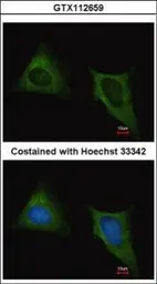 Anti-beta Tubulin antibody used in Immunocytochemistry/ Immunofluorescence (ICC/IF). GTX112659