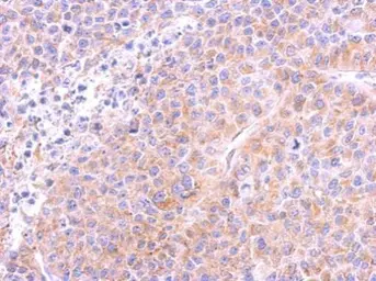 Anti-beta Tubulin antibody used in IHC (Paraffin sections) (IHC-P). GTX112659