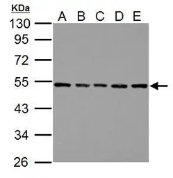 Anti-beta Tubulin antibody used in Western Blot (WB). GTX112659