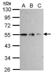 Anti-beta Tubulin antibody used in Western Blot (WB). GTX112659