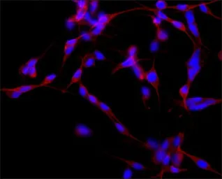 Anti-MAP2 antibody [HM-2] used in Immunocytochemistry/ Immunofluorescence (ICC/IF). GTX11267