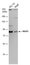 Anti-MAP2 antibody [HM-2] used in Western Blot (WB). GTX11267