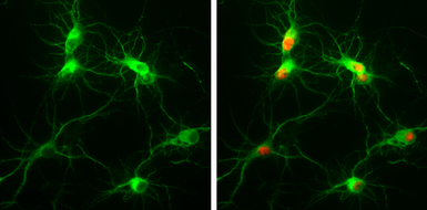 Anti-MAP2 antibody [HM-2] used in Immunocytochemistry/ Immunofluorescence (ICC/IF). GTX11267