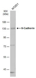 Anti-N-Cadherin antibody [N2C1], Internal used in Western Blot (WB). GTX112733